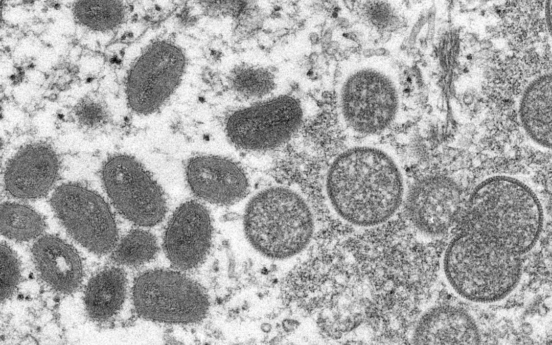 UN Warns Stigmatizing Language Used In Monkeypox Coverage Could Jeopardize Public Health